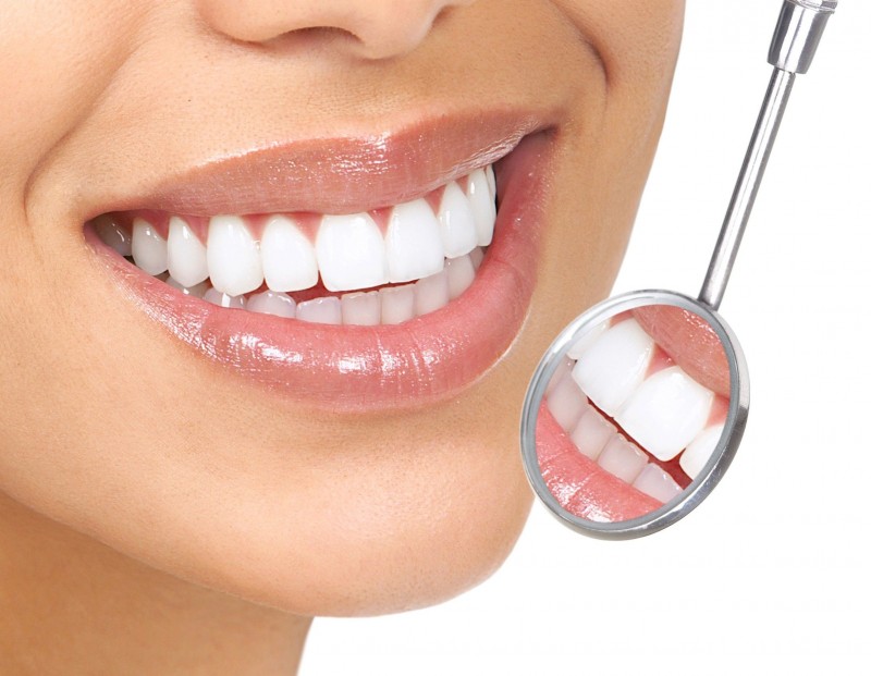 What to Know about Teeth Whitening in Indianapolis IN