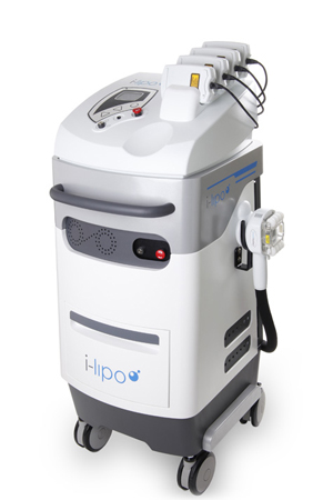 3 Reasons to Consider a Liposuction Alternative in Toledo, Ohio